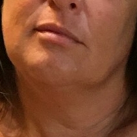 Lady Lara Nackt