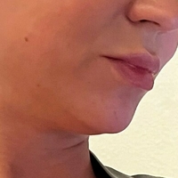 misslobatox Nackt