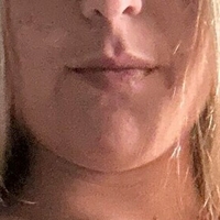 mixxxie3 Nackt