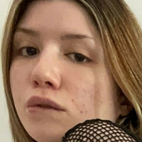 sumchloefree Nackt