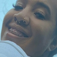 xteeacakessfreex Nackt